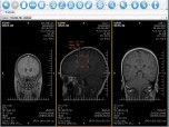 XRayline Workstation 64 bit