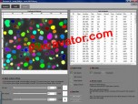 Pixcavator IA - Image Analysis