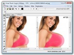 Virtual Plastic Surgery Software Screenshot