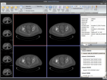 Agnosco DICOM Viewer Screenshot