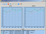 Audiometer