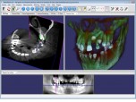 DentalViewer Screenshot